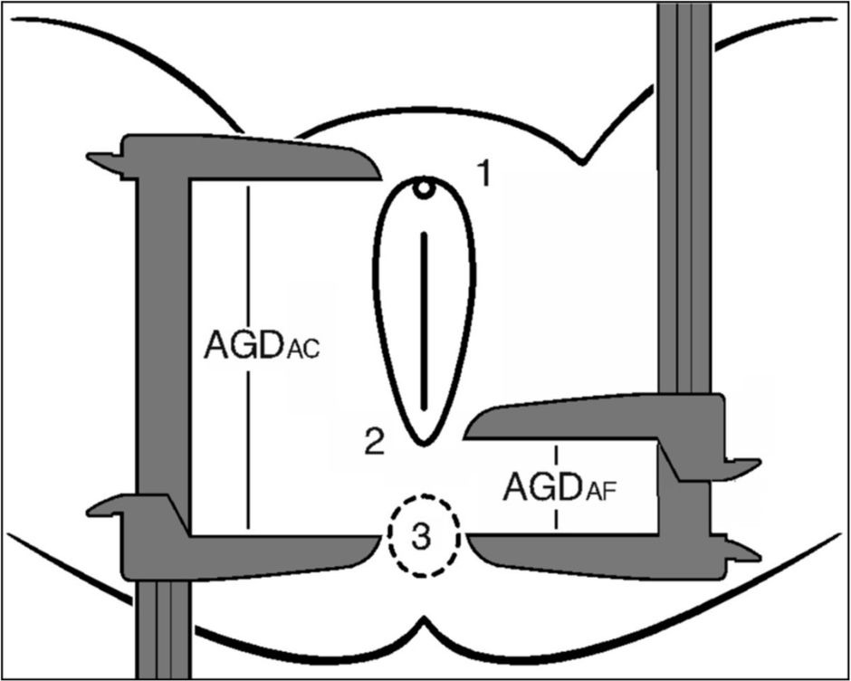 Measuring the Decrease in Anogenital Distance (AGE) Measuring the Decrease iMeasuring the Decrease in Anogenital Distance (AGE)n Anogenital Distance (AGE)
